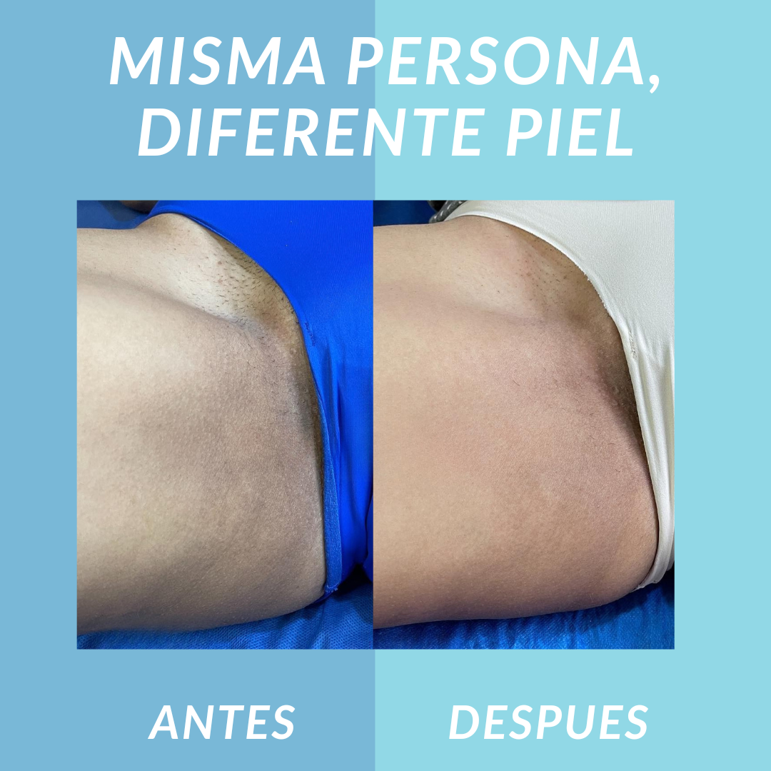 Nutrivia Jelly Booster Aceite Anti-Manchas y Pigmentación