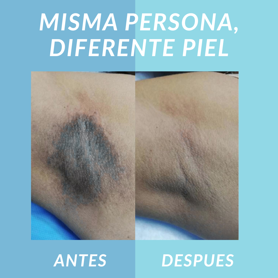 Nutrivia Jelly Booster Aceite Anti-Manchas y Pigmentación