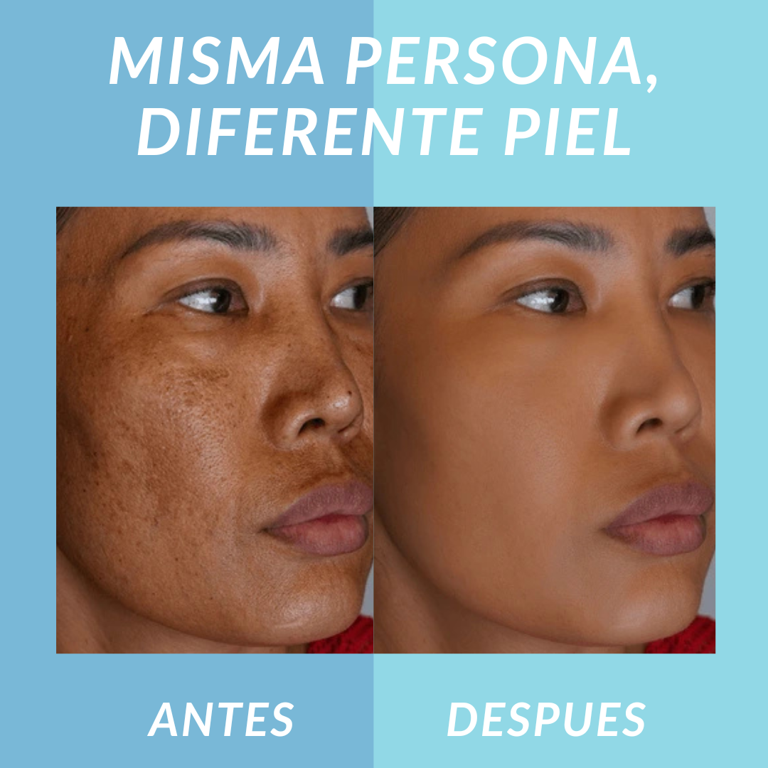 Nutrivia Jelly Booster Aceite Anti-Manchas y Pigmentación